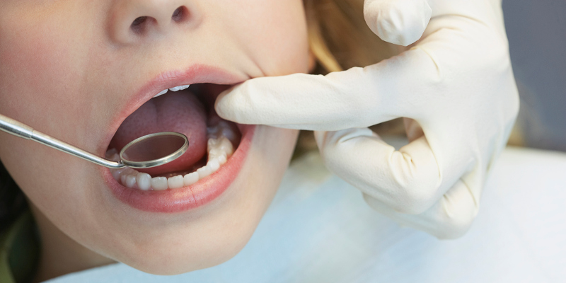 4 Benefits of Having a Family Dentist